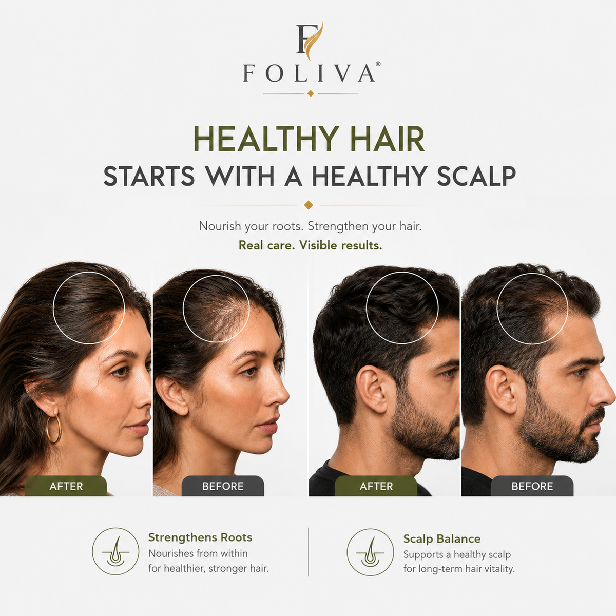 FOLIVA Advanced Hair Growth Serum — 50 mL